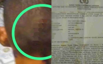 Wartawan dianiaya Adik ipar, Poldasu didesak Evaluasi Kinerja Polsek Medan Tembung Terkesan Lambat