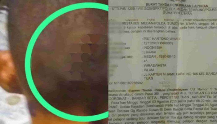 Wartawan dianiaya Adik ipar, Poldasu didesak Evaluasi Kinerja Polsek Medan Tembung Terkesan Lambat